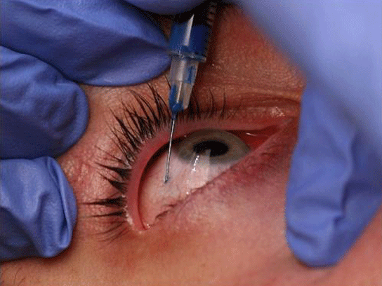 ¿Son los ojos el espejo de nuestra mente?