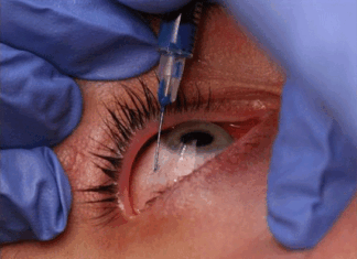 ¿Son los ojos el espejo de nuestra mente?