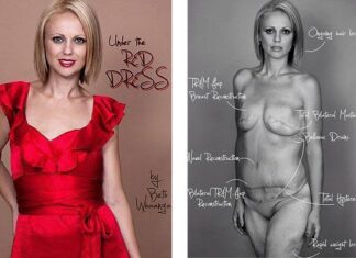 Una Mujer Pierde 100 Amigos en Facebook por colgar Fotos del Cáncer Una Mujer Pierde 100 Amigos en Facebook por colgar Fotos del Cáncer
