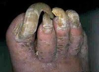 Fotografias estrafalarias