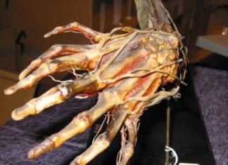 3 hallazgos médicos espeluznantes