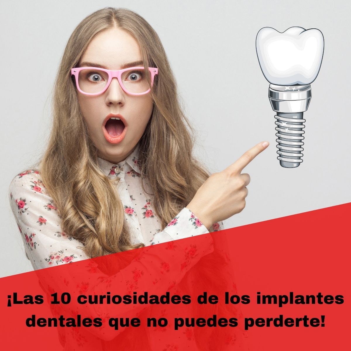 curiosidades sobre los implantes dentales